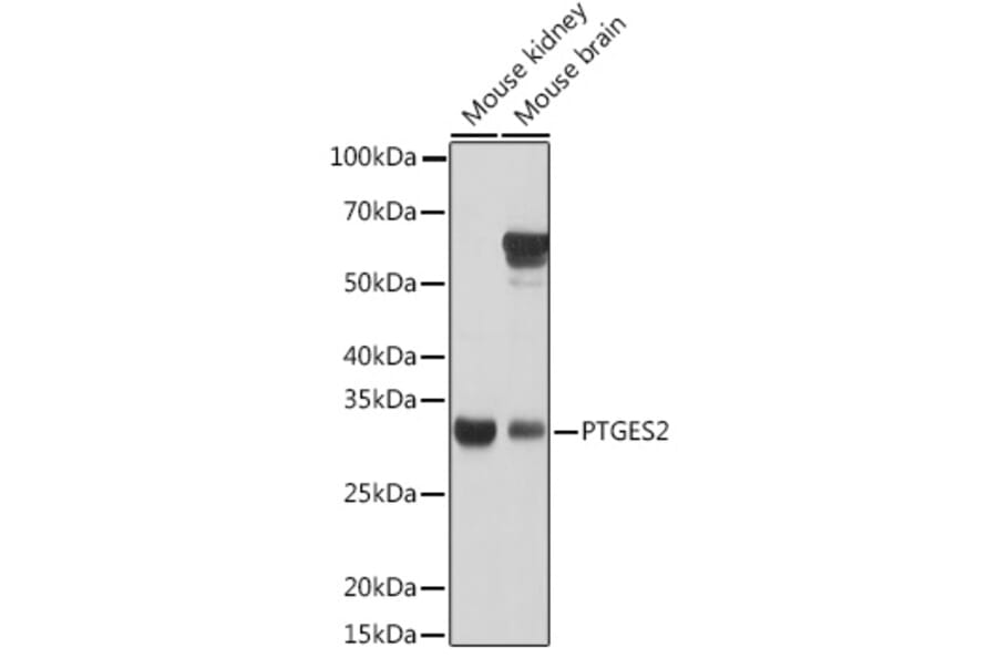 Western Blot - Anti-PTGES2/Gbf1 Antibody (A15561) - Antibodies.com