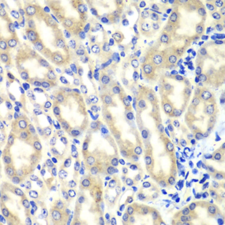 Immunohistochemistry - Anti-PTGES2/Gbf1 Antibody (A15561) - Antibodies.com