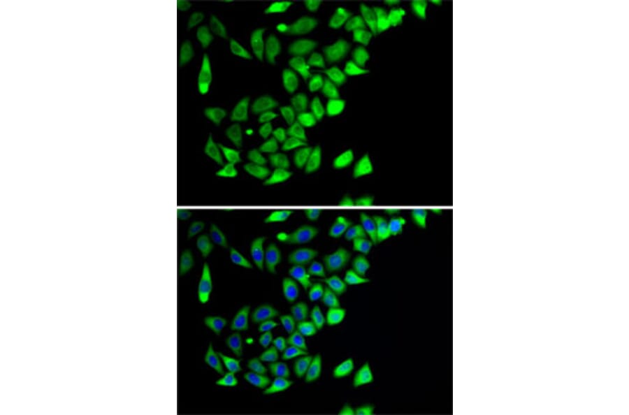 Immunofluorescence - Anti-PTGES2/Gbf1 Antibody (A15561) - Antibodies.com