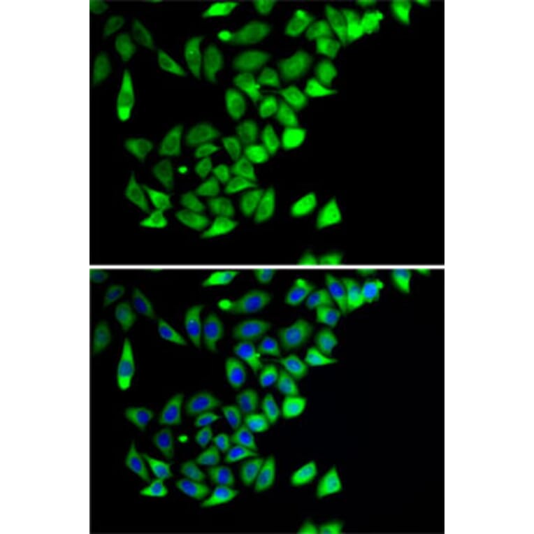 Immunofluorescence - Anti-PTGES2/Gbf1 Antibody (A15561) - Antibodies.com