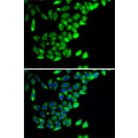 Immunofluorescence - Anti-PTGES2/Gbf1 Antibody (A15561) - Antibodies.com