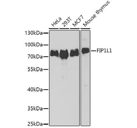 Western Blot - Anti-FIP1L1 Antibody (A15562) - Antibodies.com
