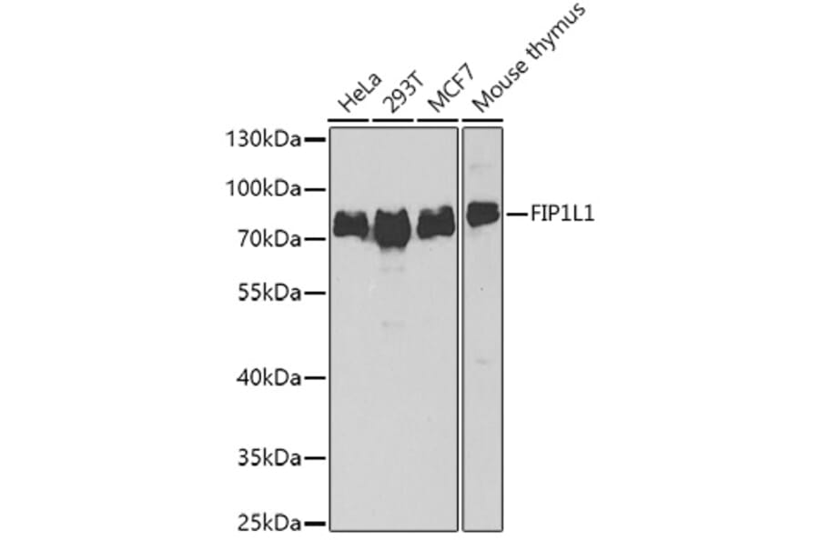 Western Blot - Anti-FIP1L1 Antibody (A15562) - Antibodies.com