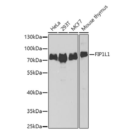 Western Blot - Anti-FIP1L1 Antibody (A15562) - Antibodies.com