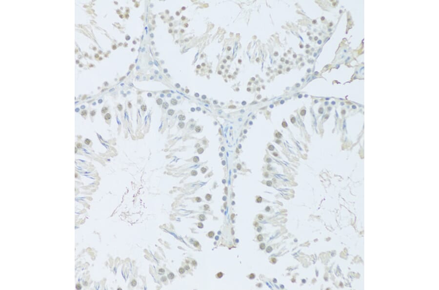 Immunohistochemistry - Anti-FIP1L1 Antibody (A15562) - Antibodies.com