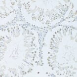 Immunohistochemistry - Anti-FIP1L1 Antibody (A15562) - Antibodies.com