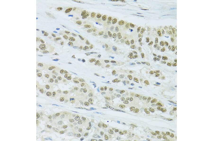 Immunohistochemistry - Anti-FIP1L1 Antibody (A15562) - Antibodies.com