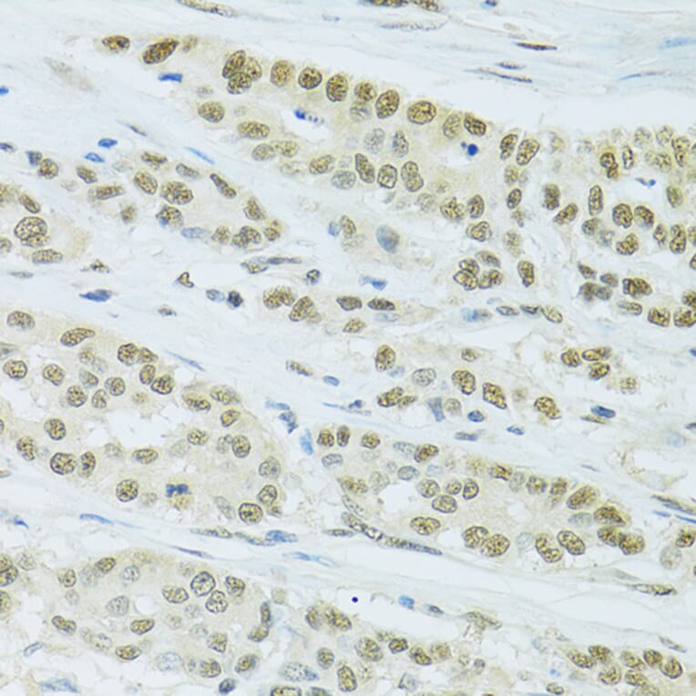 Immunohistochemistry - Anti-FIP1L1 Antibody (A15562) - Antibodies.com