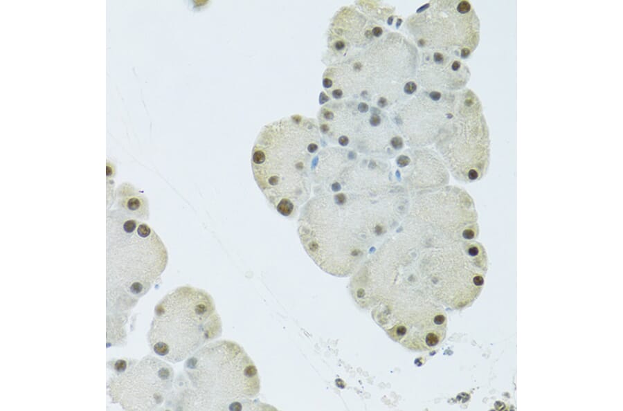 Immunohistochemistry - Anti-FIP1L1 Antibody (A15562) - Antibodies.com