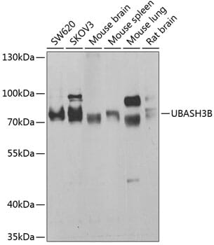 Western blot analysis of extracts of various cell lines, using Anti-UBASH3B Antibody (A7141) at 1:1,000 dilution.
Secondary antibody: Goat Anti-Rabbit IgG (H+L) (HRP) (AS014) at 1:10,000 dilution.
Lysates / proteins: 25µg per lane.
Blocking buffer: 3% non-fat dry milk in TBST.
Detection: ECL Basic Kit (RM00020).
Exposure time: 30s.