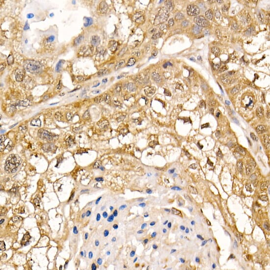 Immunohistochemistry of paraffin-embedded rat spleen using Anti-UBASH3B Antibody (A7141) at dilution of 1:100 (40x lens).