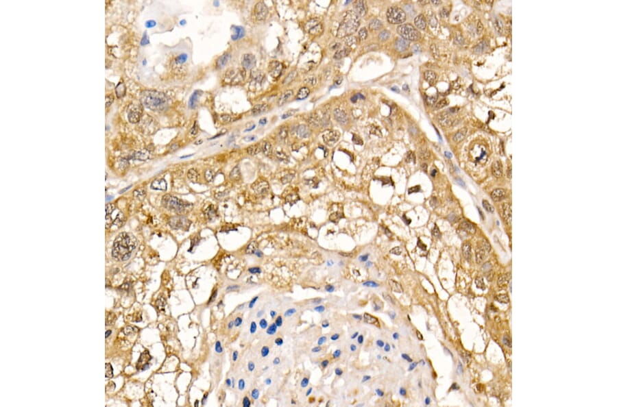 Immunohistochemistry - Anti-Sts1 Antibody (A15563) - Antibodies.com
