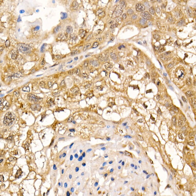 Immunohistochemistry - Anti-Sts1 Antibody (A15563) - Antibodies.com