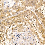 Immunohistochemistry - Anti-Sts1 Antibody (A15563) - Antibodies.com