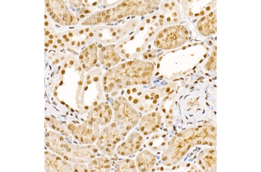 Immunohistochemistry - Anti-Sts1 Antibody (A15563) - Antibodies.com