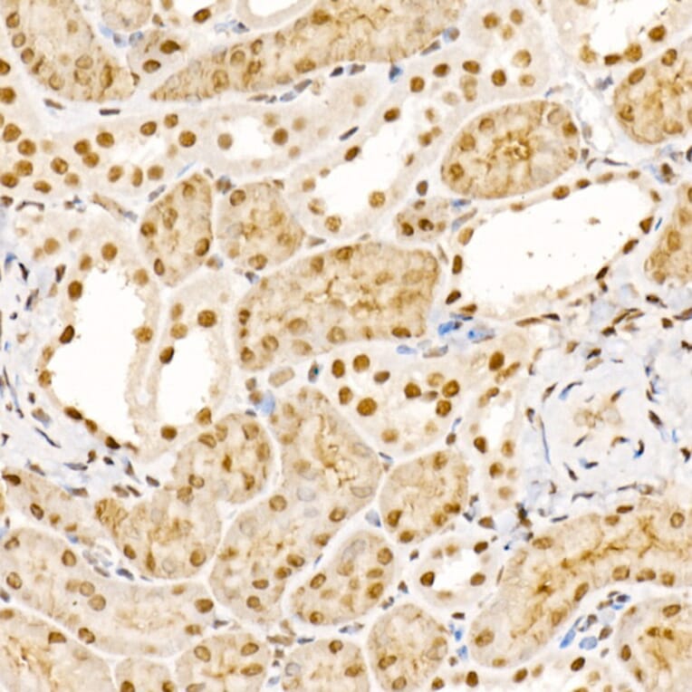Immunohistochemistry - Anti-Sts1 Antibody (A15563) - Antibodies.com