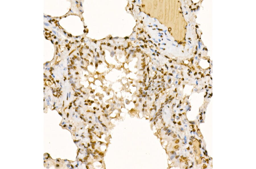 Immunohistochemistry - Anti-Sts1 Antibody (A15563) - Antibodies.com