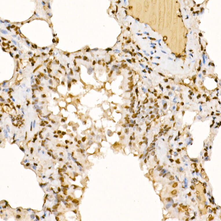 Immunohistochemistry - Anti-Sts1 Antibody (A15563) - Antibodies.com