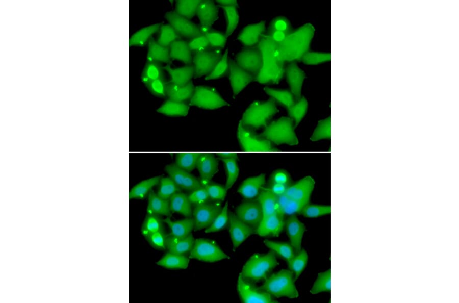 Immunofluorescence - Anti-Sts1 Antibody (A15563) - Antibodies.com