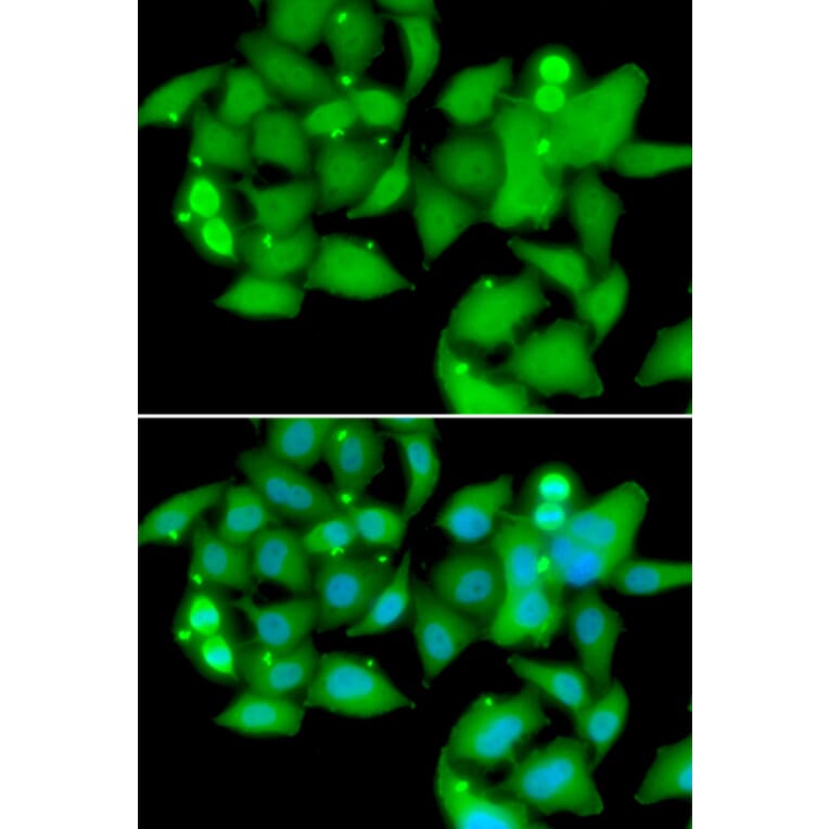 Immunofluorescence - Anti-Sts1 Antibody (A15563) - Antibodies.com
