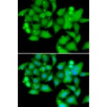 Immunofluorescence - Anti-Sts1 Antibody (A15563) - Antibodies.com