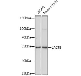 Western Blot - Anti-LACTB Antibody (A15564) - Antibodies.com