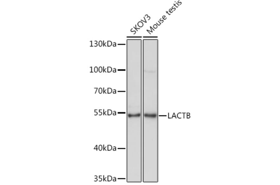 Western Blot - Anti-LACTB Antibody (A15564) - Antibodies.com