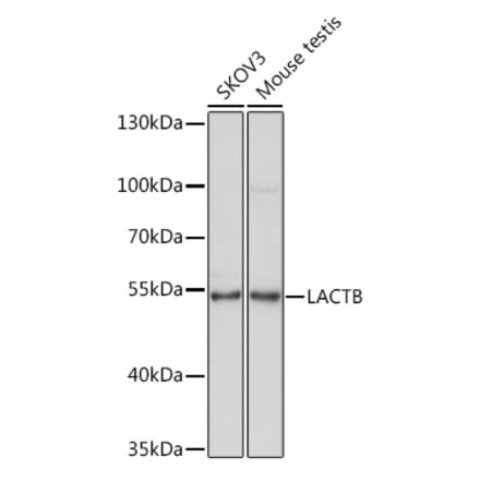 Western Blot - Anti-LACTB Antibody (A15564) - Antibodies.com