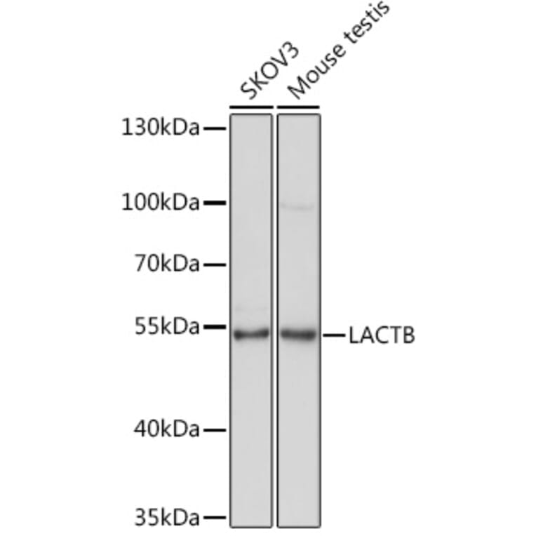 Western Blot - Anti-LACTB Antibody (A15564) - Antibodies.com