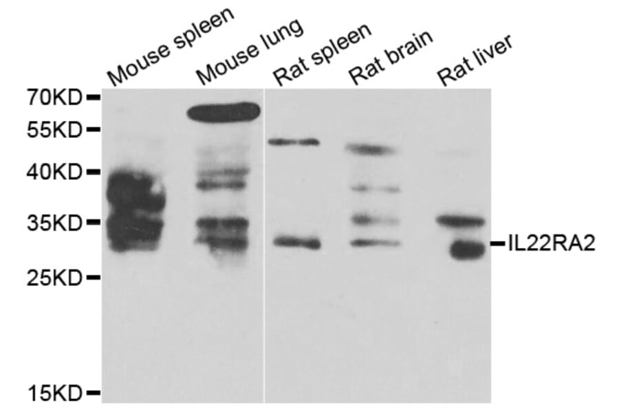Western Blot - Anti-IL22RA2 Antibody (A7145) - Antibodies.com