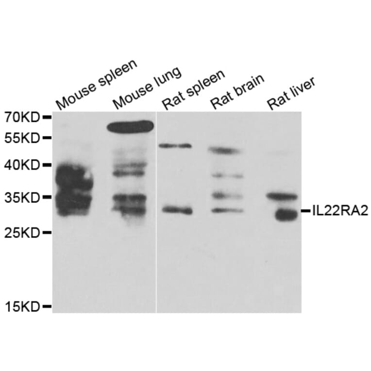 Western Blot - Anti-IL22RA2 Antibody (A7145) - Antibodies.com