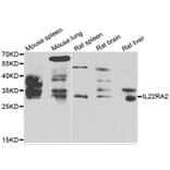 Western Blot - Anti-IL22RA2 Antibody (A7145) - Antibodies.com
