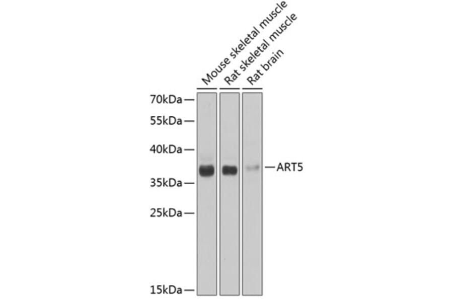 Western Blot - Anti-ART5 Antibody (A7146) - Antibodies.com