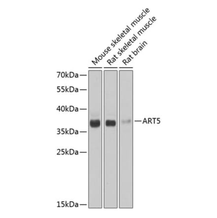 Western Blot - Anti-ART5 Antibody (A15566) - Antibodies.com