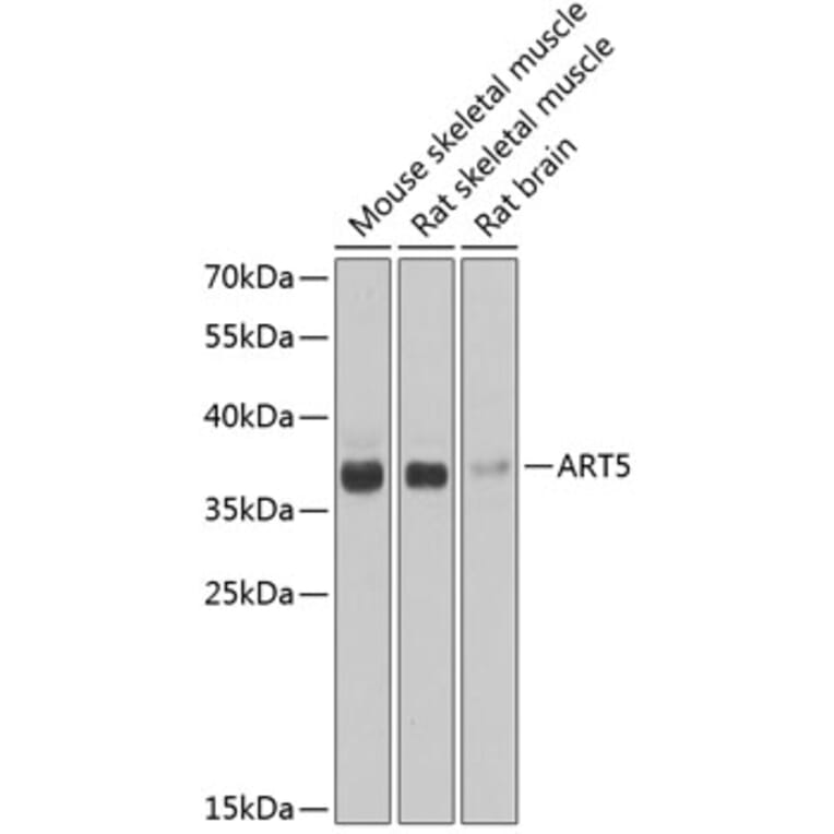 Western Blot - Anti-ART5 Antibody (A7146) - Antibodies.com