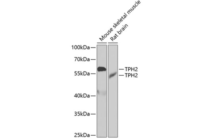 Western Blot - Anti-TPH2 Antibody (A15567) - Antibodies.com
