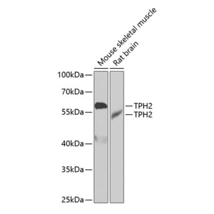 Western Blot - Anti-TPH2 Antibody (A15567) - Antibodies.com