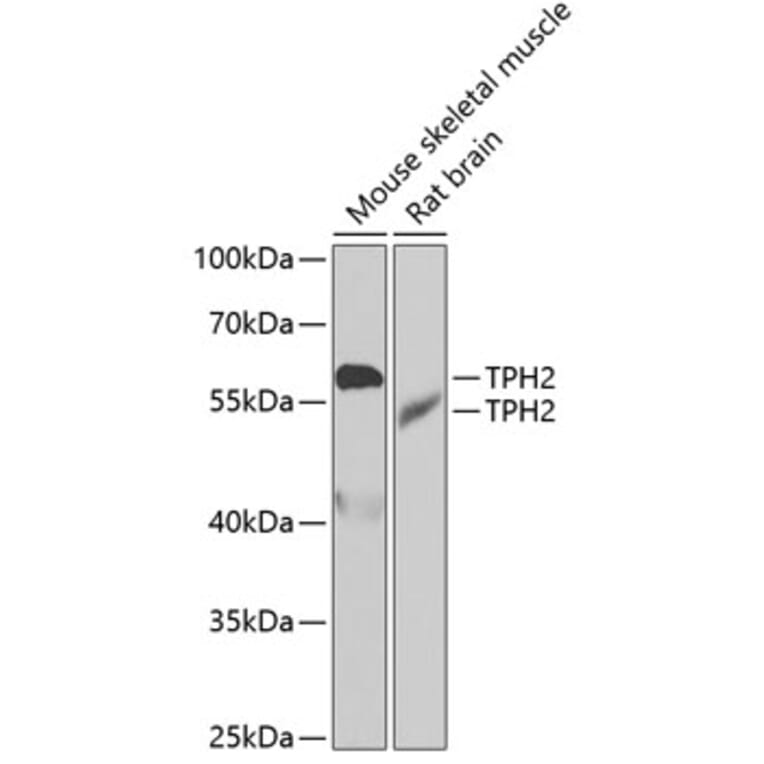 Western Blot - Anti-TPH2 Antibody (A15567) - Antibodies.com