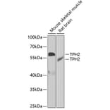 Western Blot - Anti-TPH2 Antibody (A15567) - Antibodies.com