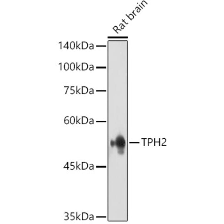 Western Blot - Anti-TPH2 Antibody (A15567) - Antibodies.com