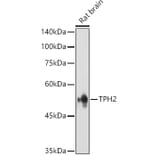 Western Blot - Anti-TPH2 Antibody (A15567) - Antibodies.com