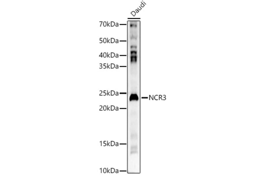 Western Blot - Anti-NKp30 Antibody (A15568) - Antibodies.com