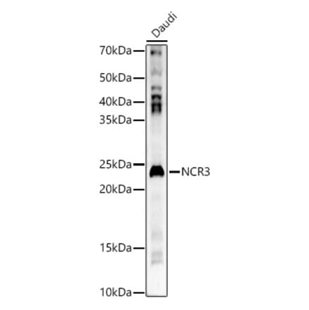 Western Blot - Anti-NKp30 Antibody (A15568) - Antibodies.com