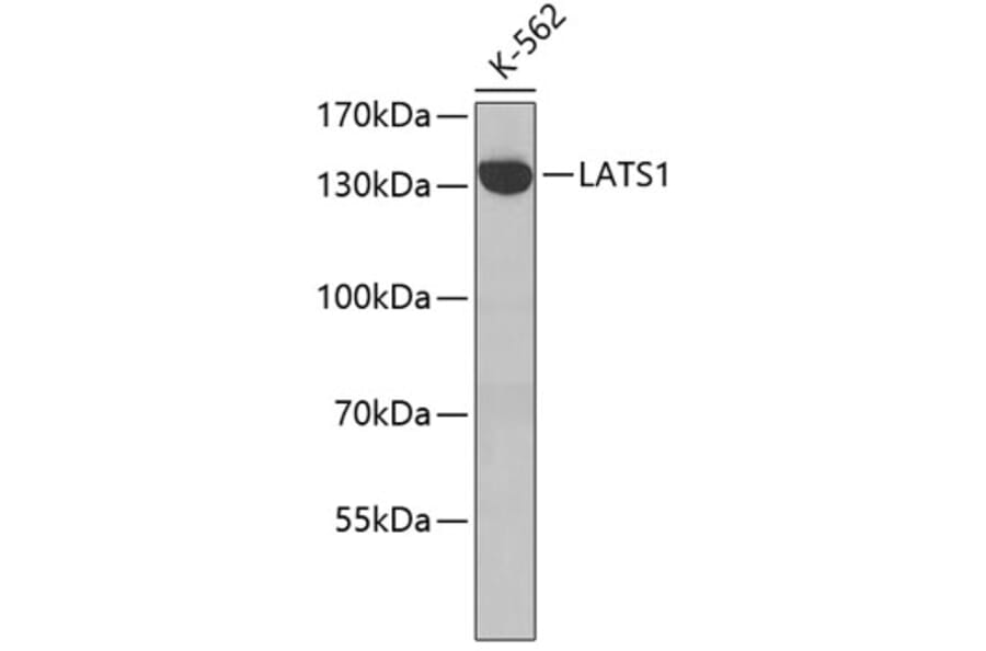 Western Blot - Anti-LATS1 Antibody (A7159) - Antibodies.com