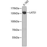 Western Blot - Anti-LATS1 Antibody (A7159) - Antibodies.com