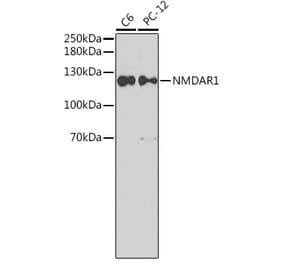 Western Blot - Anti-NMDAR1 Antibody (A15571) - Antibodies.com