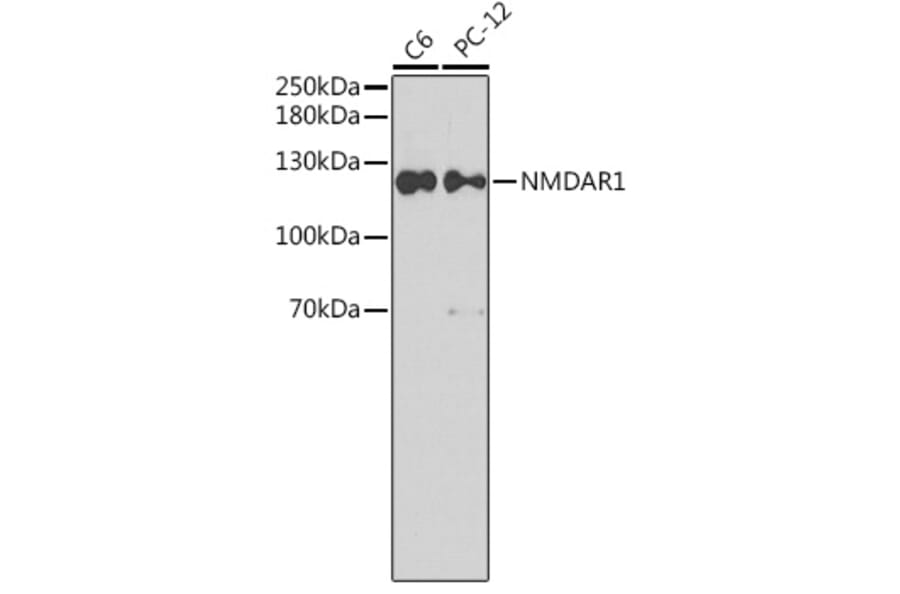 Western Blot - Anti-NMDAR1 Antibody (A15571) - Antibodies.com
