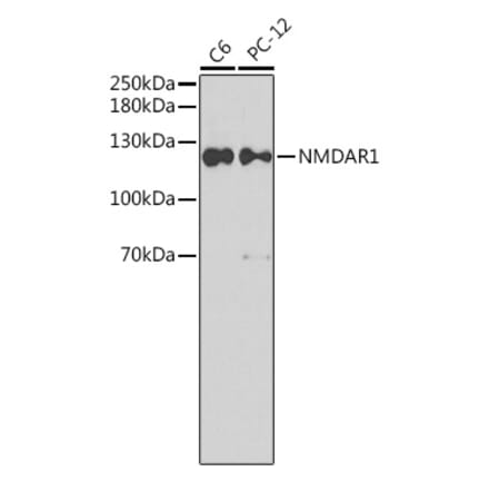 Western Blot - Anti-NMDAR1 Antibody (A15571) - Antibodies.com