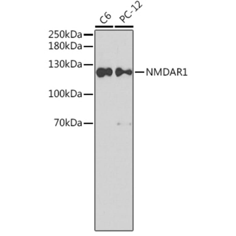 Western Blot - Anti-NMDAR1 Antibody (A15571) - Antibodies.com