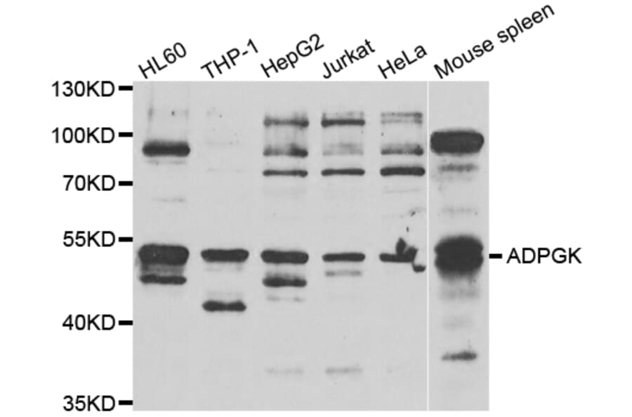 Western Blot - Anti-ADPGK Antibody (A7172) - Antibodies.com